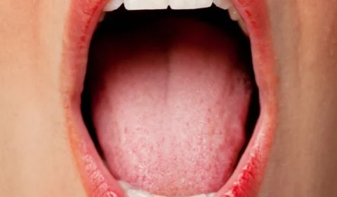 Boca seca pode provocar mau hálito? Saiba mais sobre o assunto