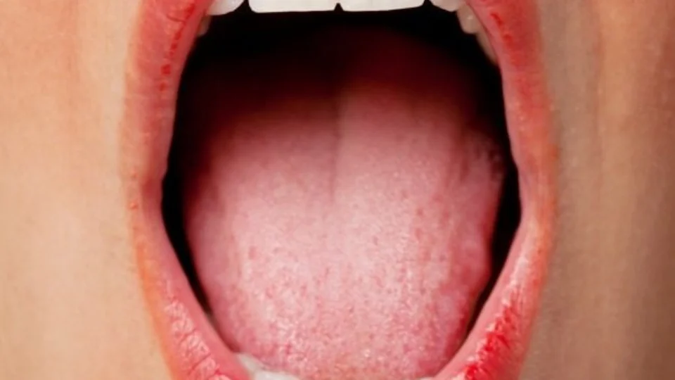 Boca seca pode provocar mau hálito? Saiba mais sobre o assunto