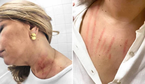 VÍDEO: Vereadora registra BO e diz que colega de partido tentou enforcá-la no banheiro da Câmara de SP