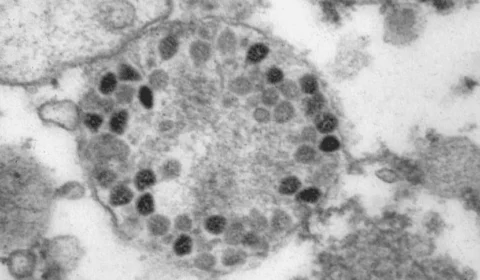 Ministério da Saúde confirma 32 casos confirmados da variante Ômicron no Brasil