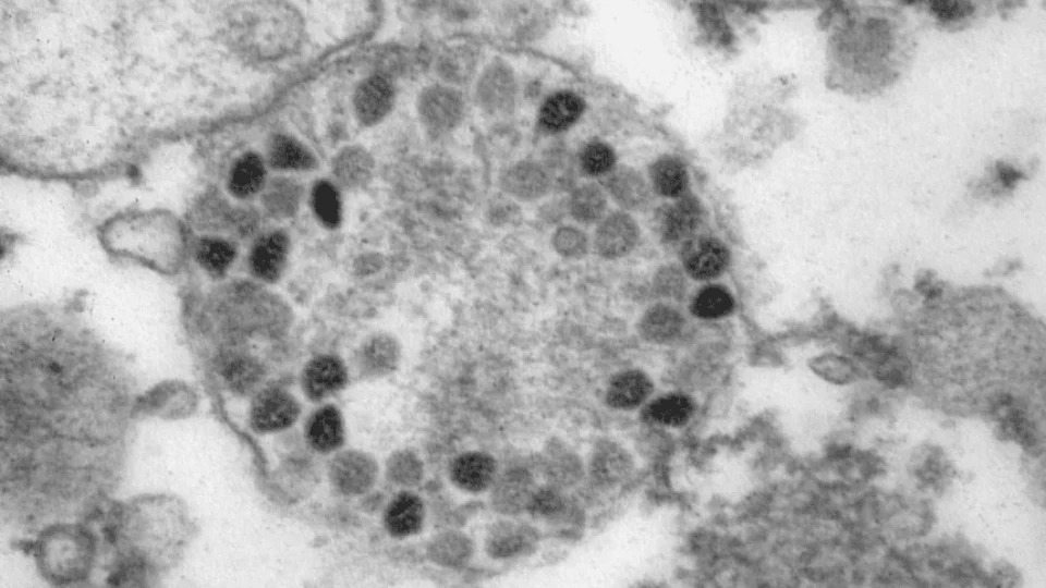 Ministério da Saúde confirma 32 casos confirmados da variante Ômicron no Brasil