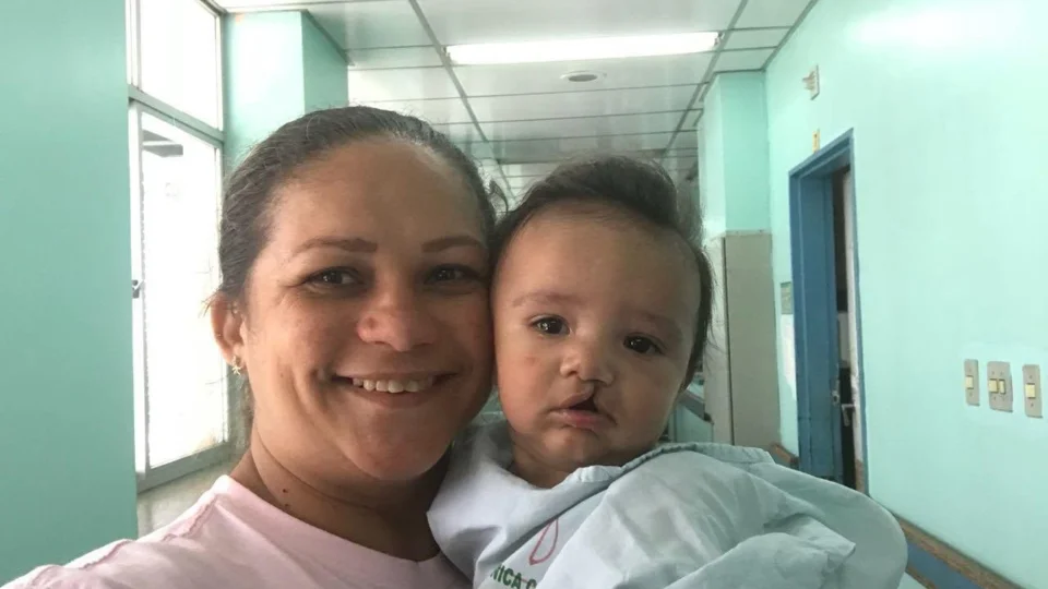 Mutirão de cirurgias de lábios leporinos e pediátricas será realizado em outubro em Manaus