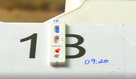 Amazonas registra 62 casos de Covid-19