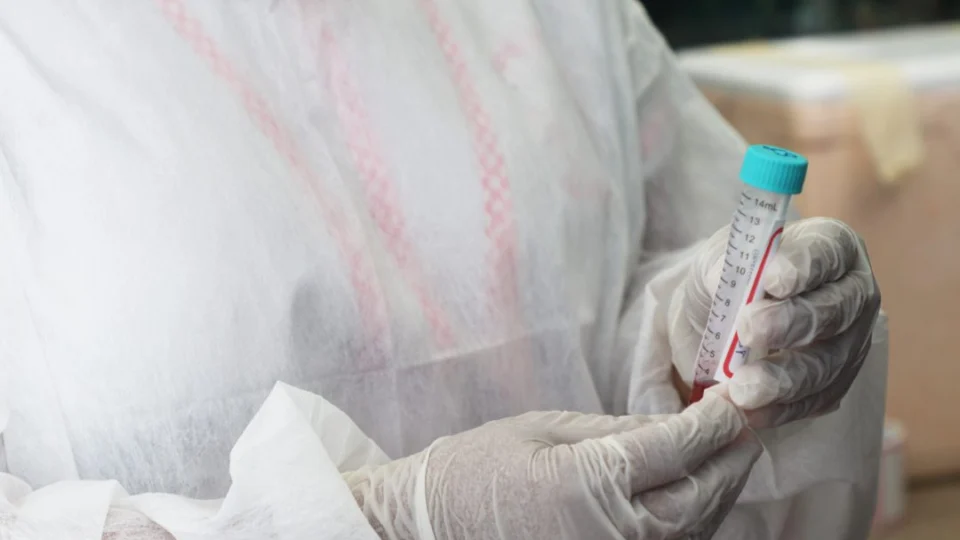 Amazonas registra 123 novos casos de Covid-19 e duas mortes em Manaus e Manacapuru