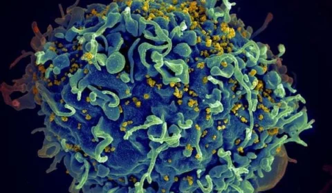 Na Argentina, cura do HIV sem tratamento pode ser o segundo caso no mundo