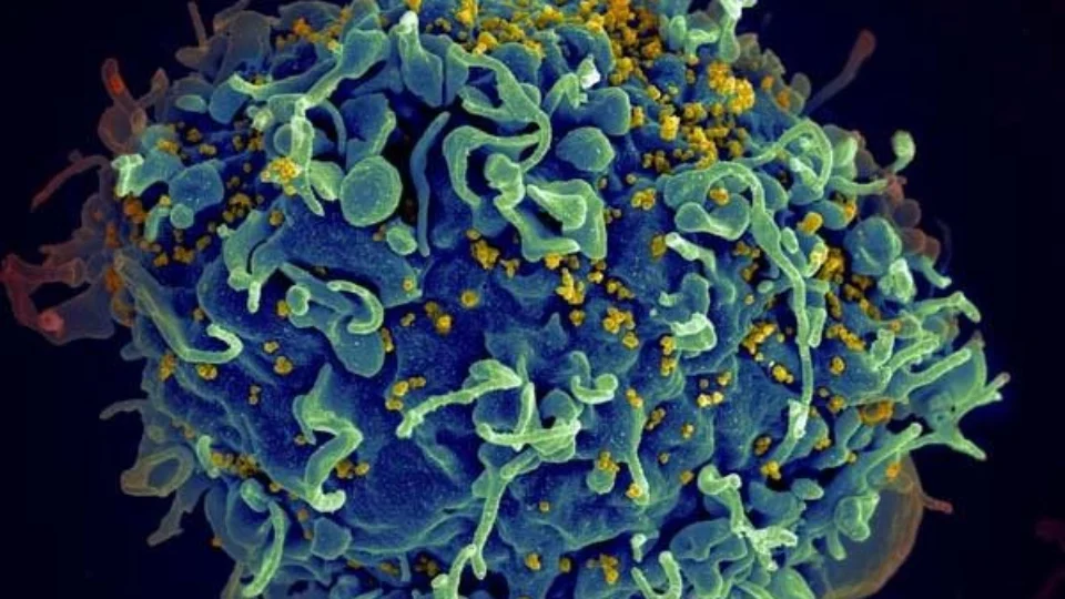 Na Argentina, cura do HIV sem tratamento pode ser o segundo caso no mundo