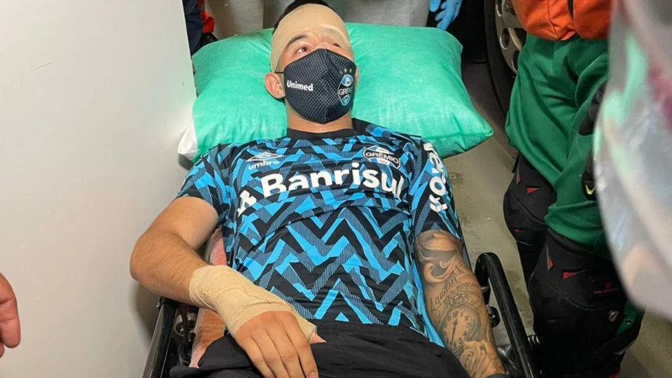 Jogadores do Grêmio ficam feridos após ônibus do time ser atingido com pedras; veja as fotos