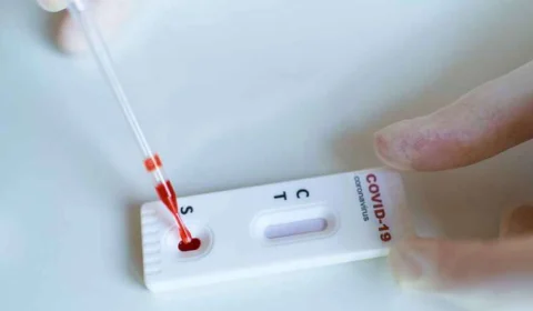 FVS informa o diagnóstico de 48 novos casos de Covid-19 e 2 mortes, no Amazonas