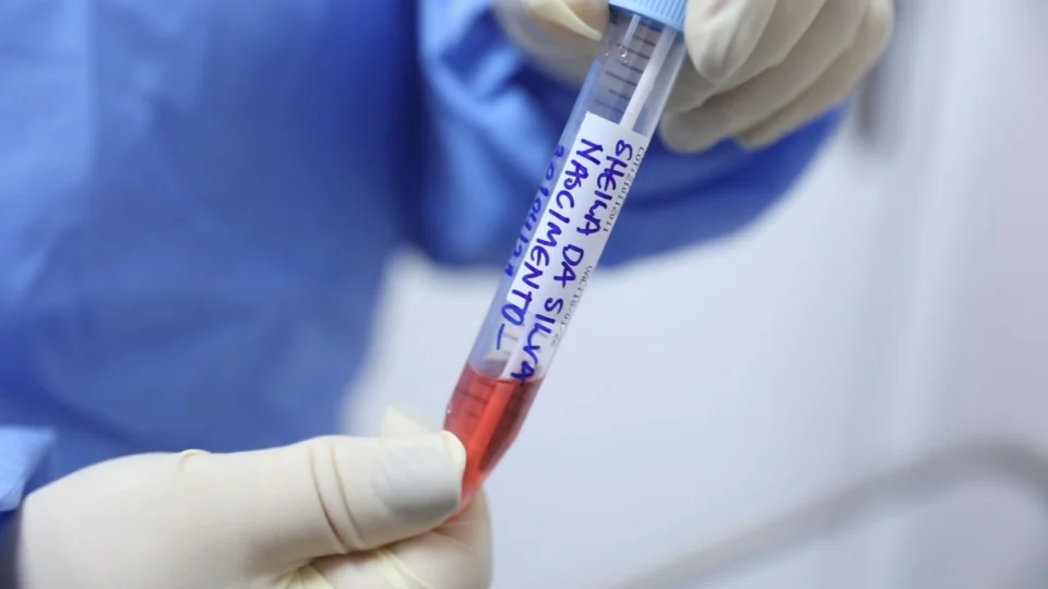 Mais de 3 mil novos casos de Covid são confirmados no AM, em 24 horas