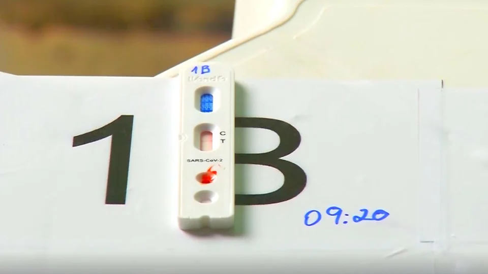 Amazonas registra duas novas mortes por Covid e 49 novos casos da doença