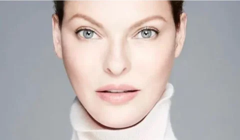 Modelo processa empresa de estética alegando estar ‘desfigurada’