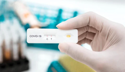 Amazonas registra 575 novos casos de Covid-19 e três mortes