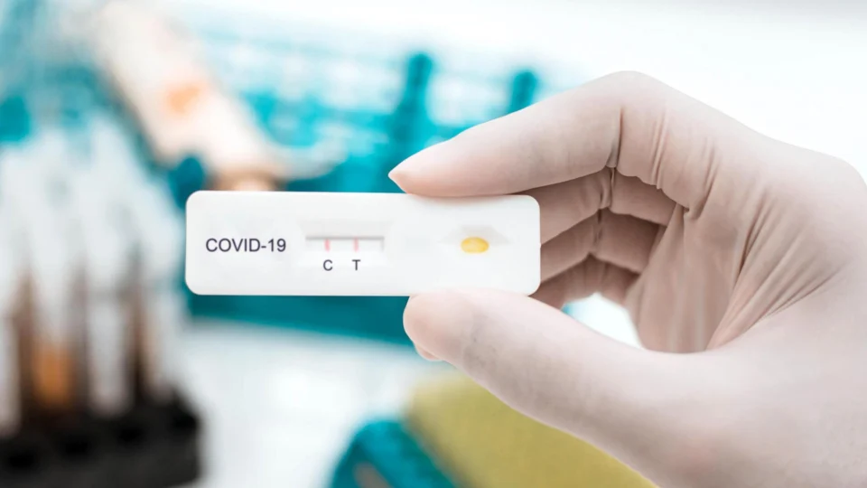 Amazonas registra 575 novos casos de Covid-19 e três mortes