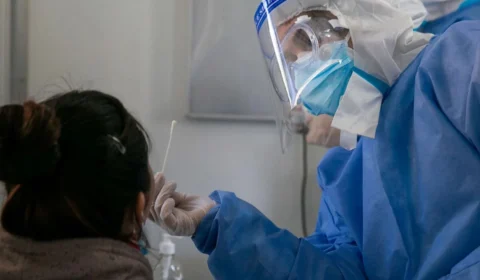 Antígeno, PCR, RT-LAMP: veja diferença entre testes em caso de suspeita de Covid-19 e Influenza