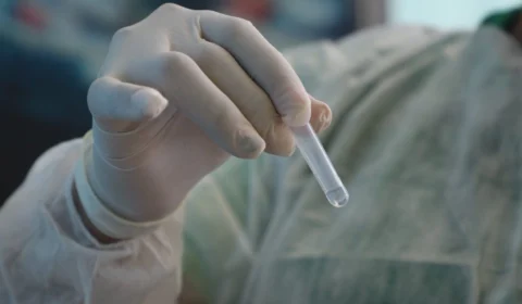 Amazonas volta a registrar mortes por Covid-19 nesta terça-feira