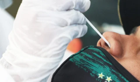 Amazonas registra 35 novos casos de Covid-19 e uma morte em Autazes