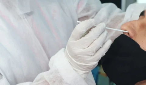 Amazonas registra 30 novos casos de Covid-19 e 1 morte