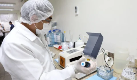 Amazonas registra duas mortes por Covid-19, aponta FVS-RCP