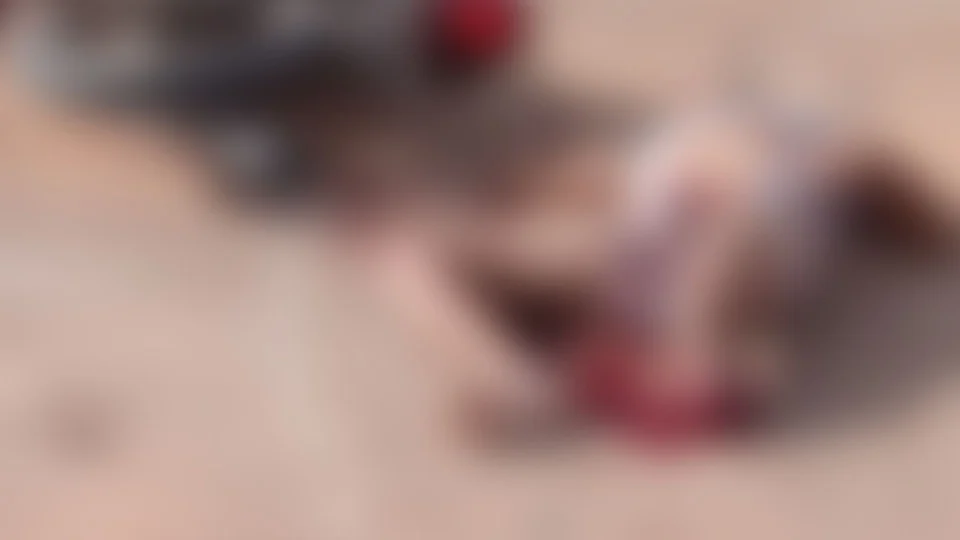 Jovem tem perna arrancada durante acidente de moto em Barreirinha-AM