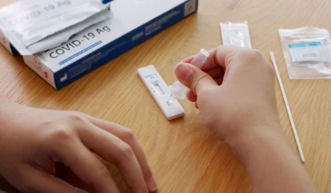 Anvisa decide nesta sexta-feira sobre liberação de autoteste