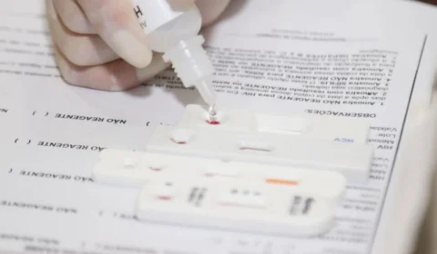 Resolução da ANS obriga planos de saúde a cobrir testes rápidos; veja como pedir