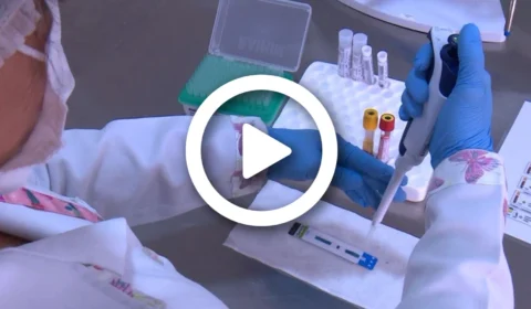 VÍDEO: nova variante do HIV é descoberta por pesquisadores da Holanda