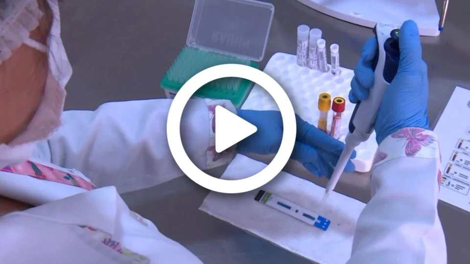 VÍDEO: nova variante do HIV é descoberta por pesquisadores da Holanda