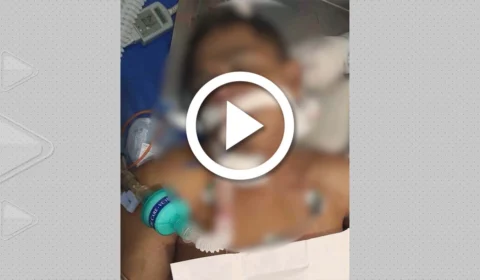 VÍDEO: homem sofre traumatismo craniano ao cair de muro em Parintins-AM