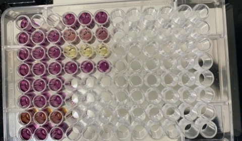 Estudo investiga espécies de cogumelos capazes de auxiliar no combate a doenças, no AM