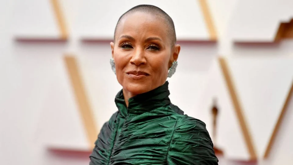 Alopecia: saiba mais sobre perda de cabelos repentina que afetam várias mulheres