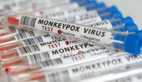 Monkeypox: Amazonas tem 9 casos confirmados e transmissão local da varíola dos macacos