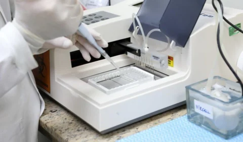 Amazonas registra um óbito e 52 casos da Covid-19 nesta terça-feira