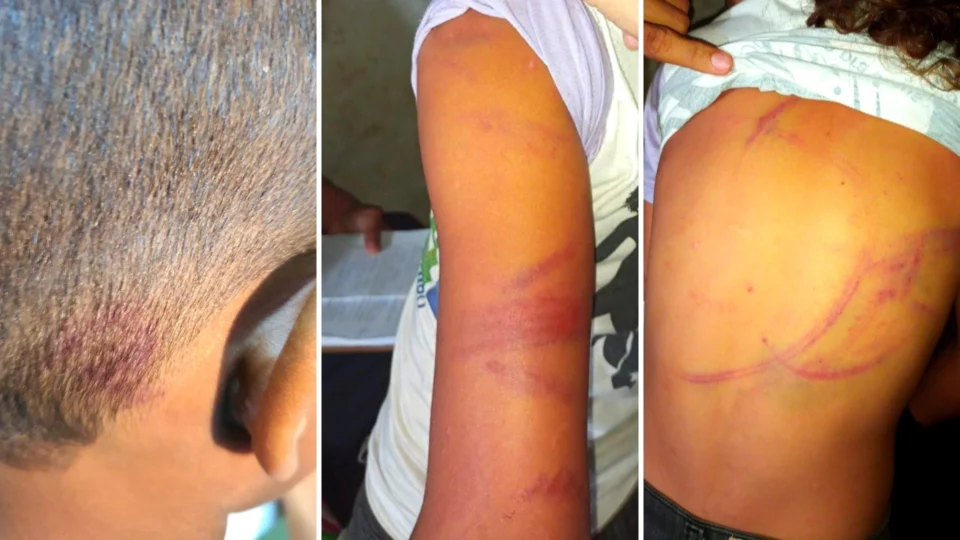 Pai é suspeito de usar fio elétrico para agredir filhos de 05 e 07 anos, em Manacapuru-AM