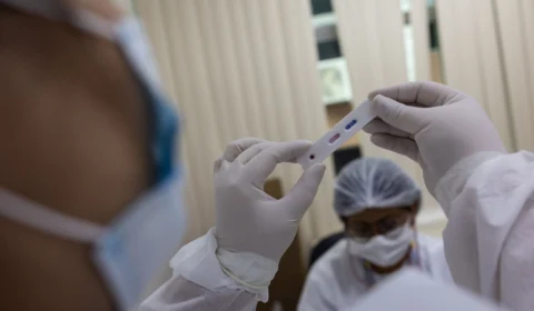 Amazonas registra 140 casos de Covid-19 neste domingo