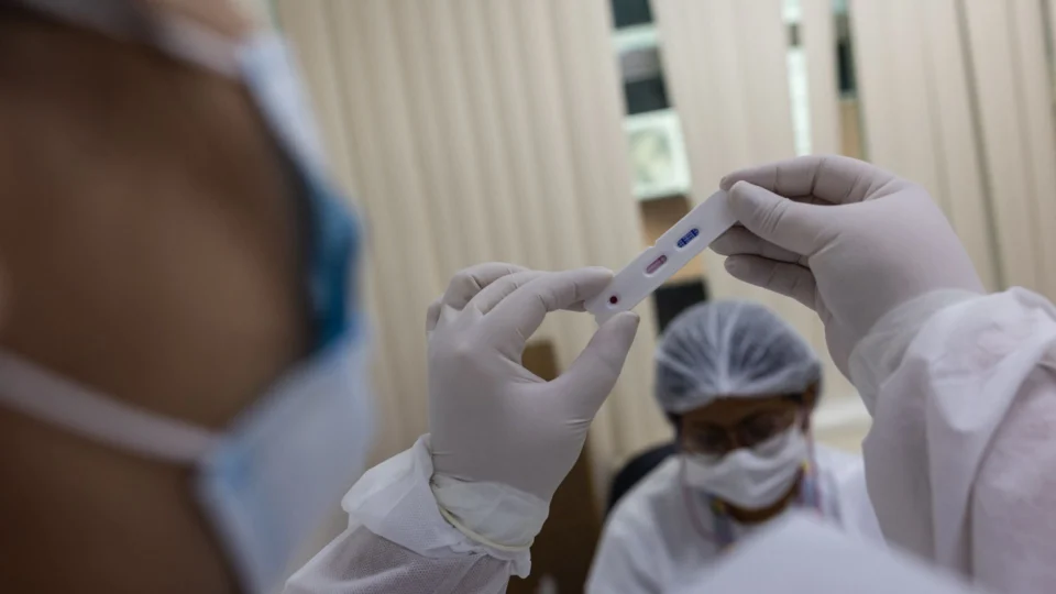 Amazonas registra 140 casos de Covid-19 neste domingo