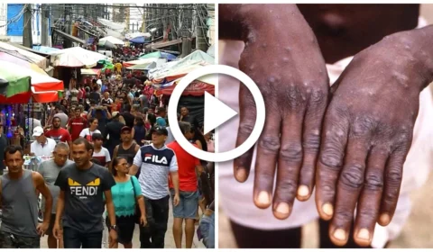 VÍDEO: casos de varíola dos macacos são confirmados no Brasil
