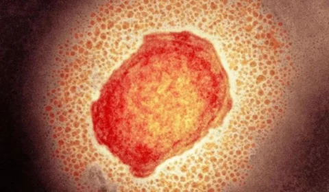 Ao menos 16 países têm casos confirmados de varíola dos macacos; veja lista