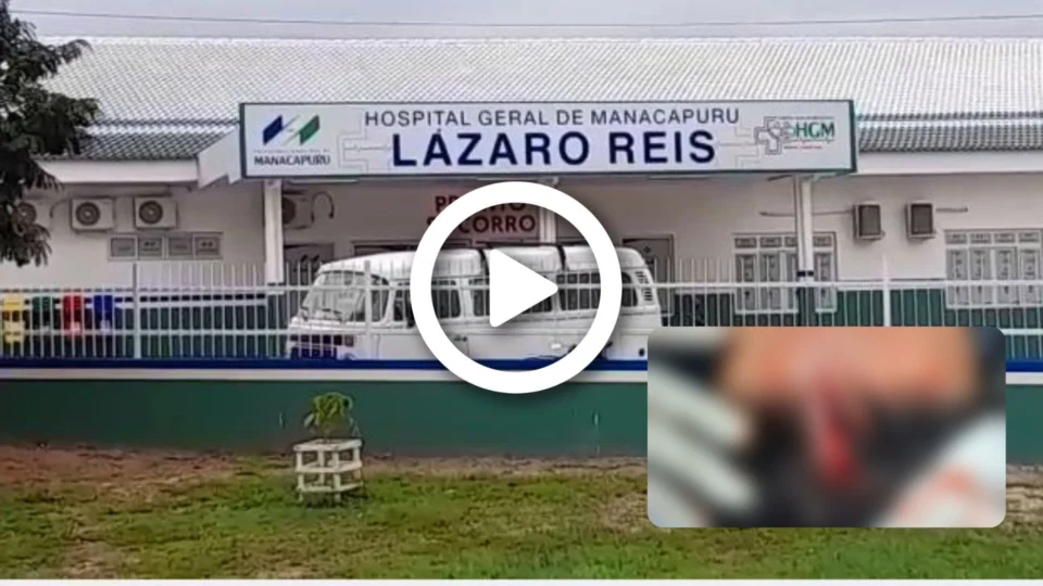 VÍDEO: funcionário de hospital é atingido com facada na cabeça durante tentativa de assalto no interior do AM