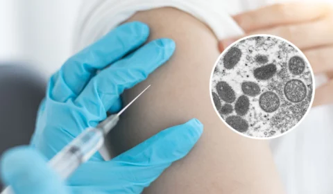 Farmacêutica dos Estados Unidos começa testes para possível vacina contra varíola dos macacos