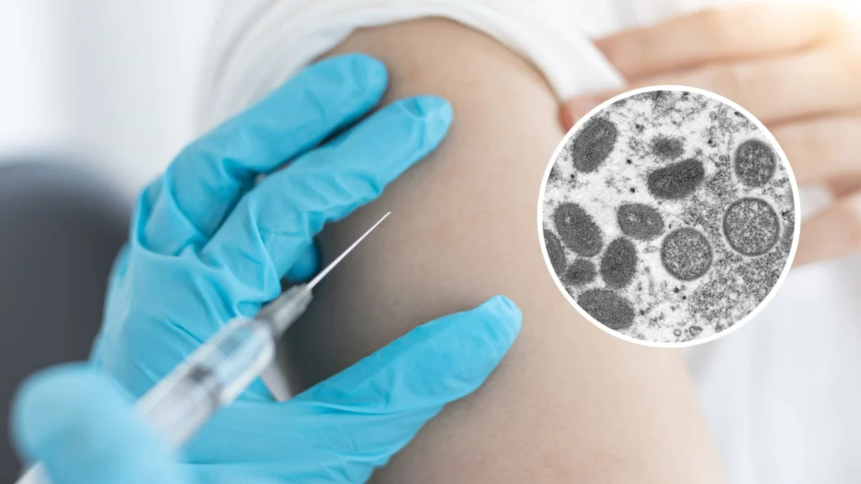 Farmacêutica dos Estados Unidos começa testes para possível vacina contra varíola dos macacos