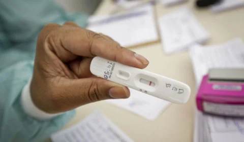 Pelo 7° dia consecutivo, Amazonas não registra mortes por Covid-19