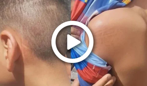 VÍDEO: adolescente de 14 anos é agredido por vizinho em Brasília