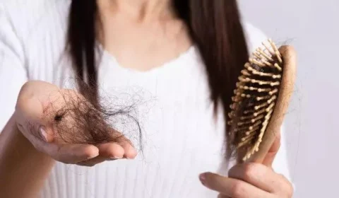 Queda de cabelo afeta 25% dos paciente com Covid-19; mulheres percebem mais o problema