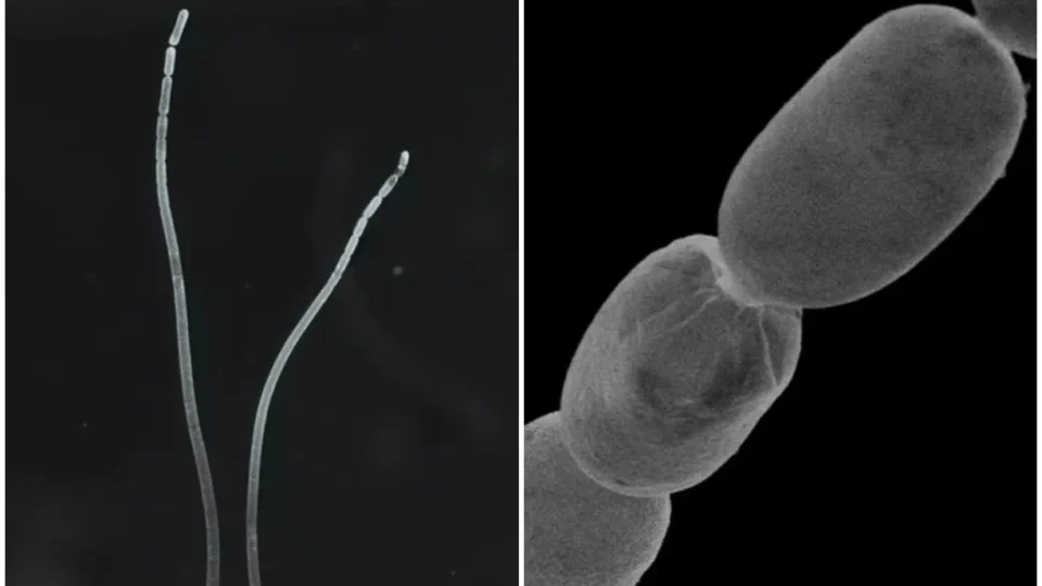 Cientistas descobrem maior bactéria já encontrada na natureza que pode ser vista a olho nu