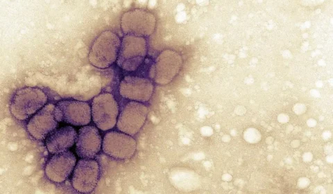 Varíola dos macacos: Inglaterra confirma propagação comunitária da doença