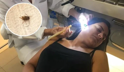 Mulher fica com barata presa no ouvido por mais de 24h, em Cabo Frio