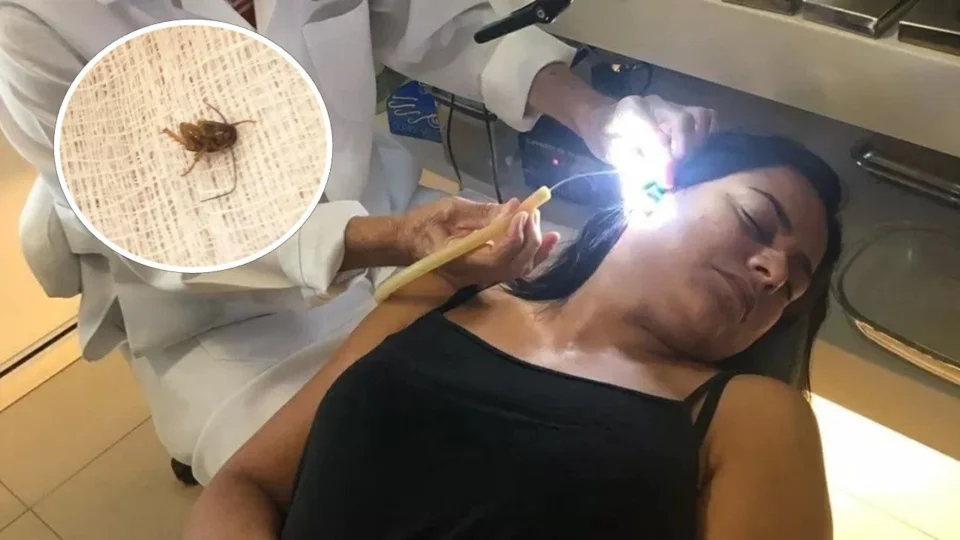 Mulher fica com barata presa no ouvido por mais de 24h, em Cabo Frio