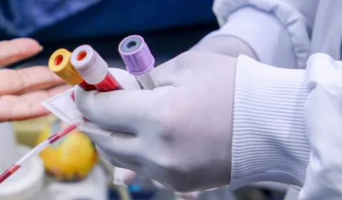 Monkeypox: Amazonas tem mais 3 notificações de casos suspeitos de varíola dos macacos