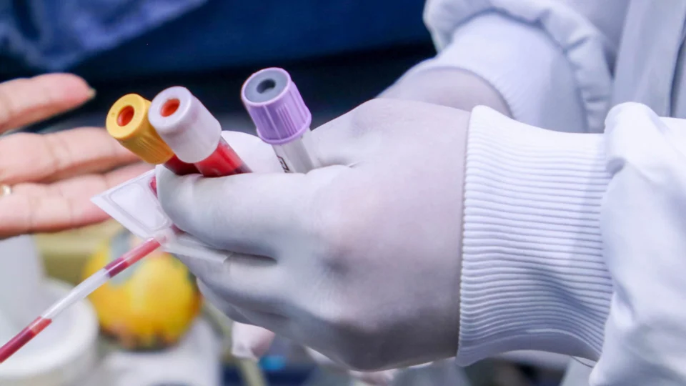 Monkeypox: Amazonas tem mais 3 notificações de casos suspeitos de varíola dos macacos