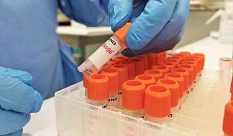 Semsa orienta unidades de saúde pública e privada sobre sintomas da varíola dos macacos, em Manaus